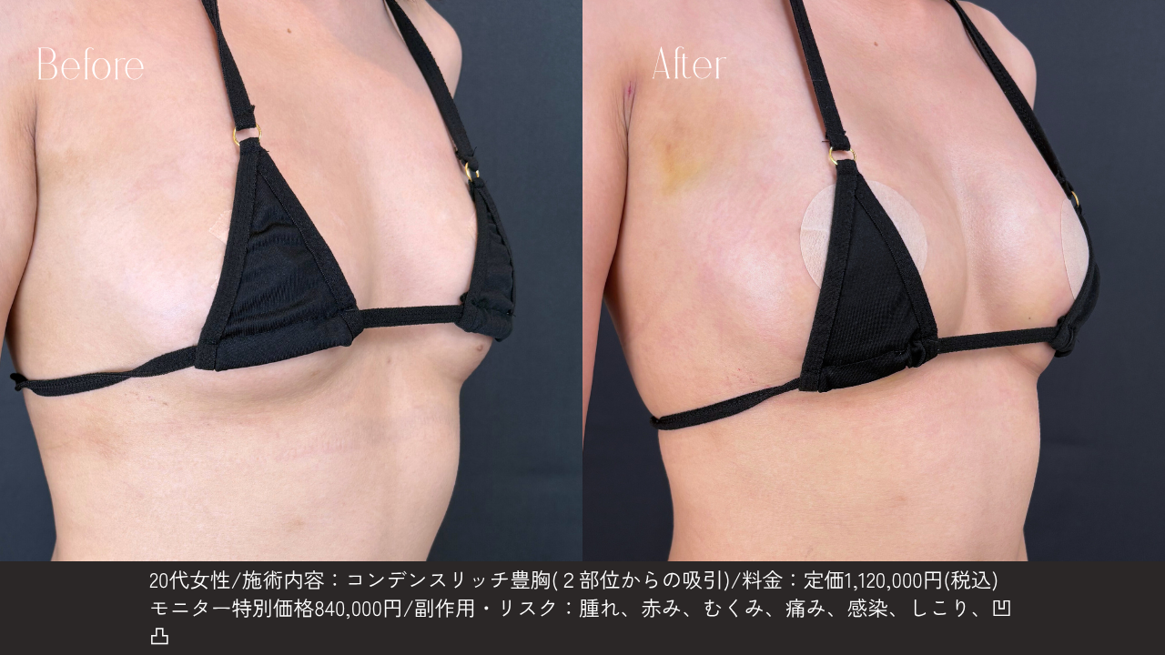 自然な仕上がりへのこだわり