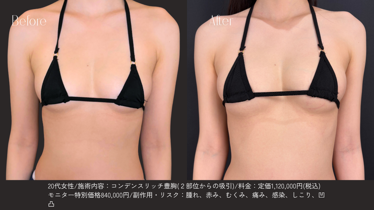 自然な仕上がりへのこだわり