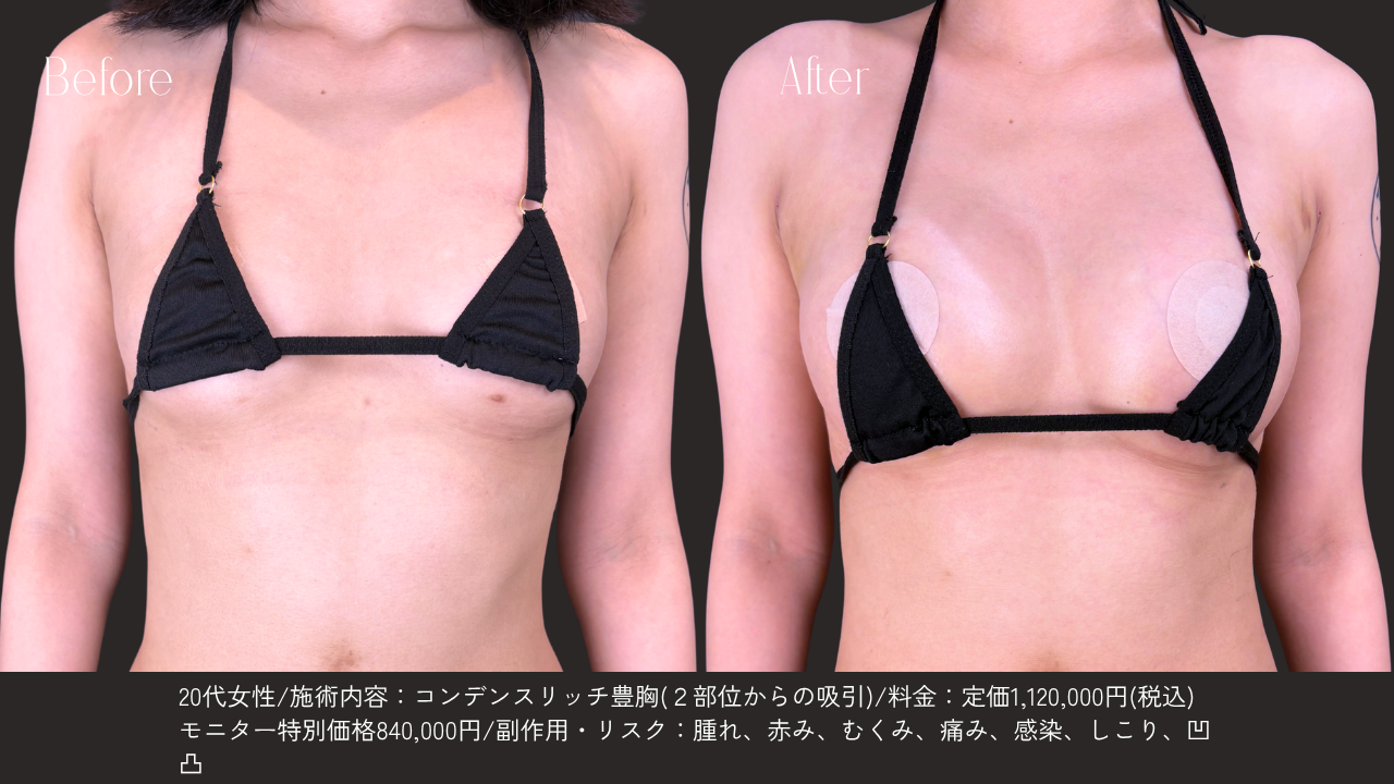 自然な仕上がりへのこだわり