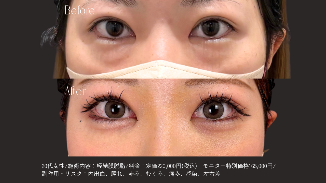 自然な仕上がりへのこだわり