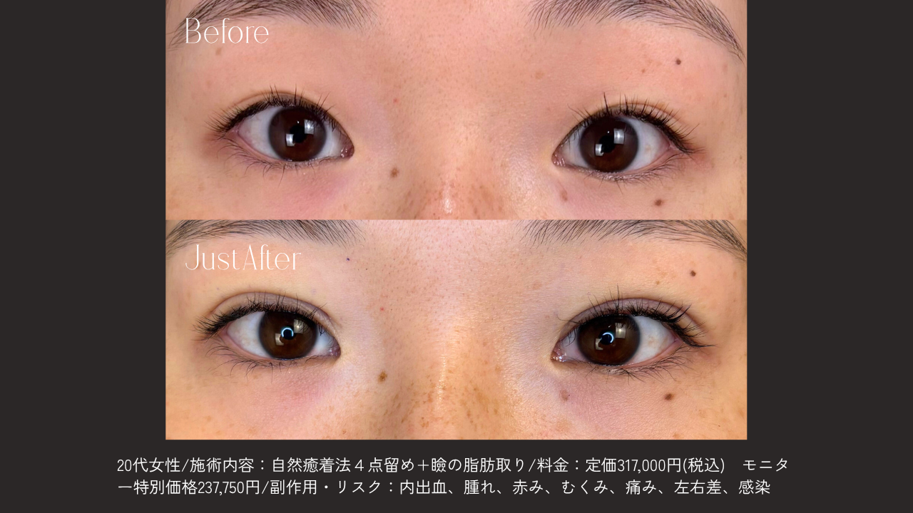 自然な仕上がりへのこだわり