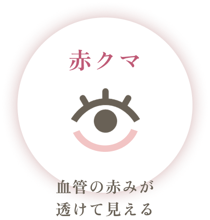 血管の赤みが透けて見える