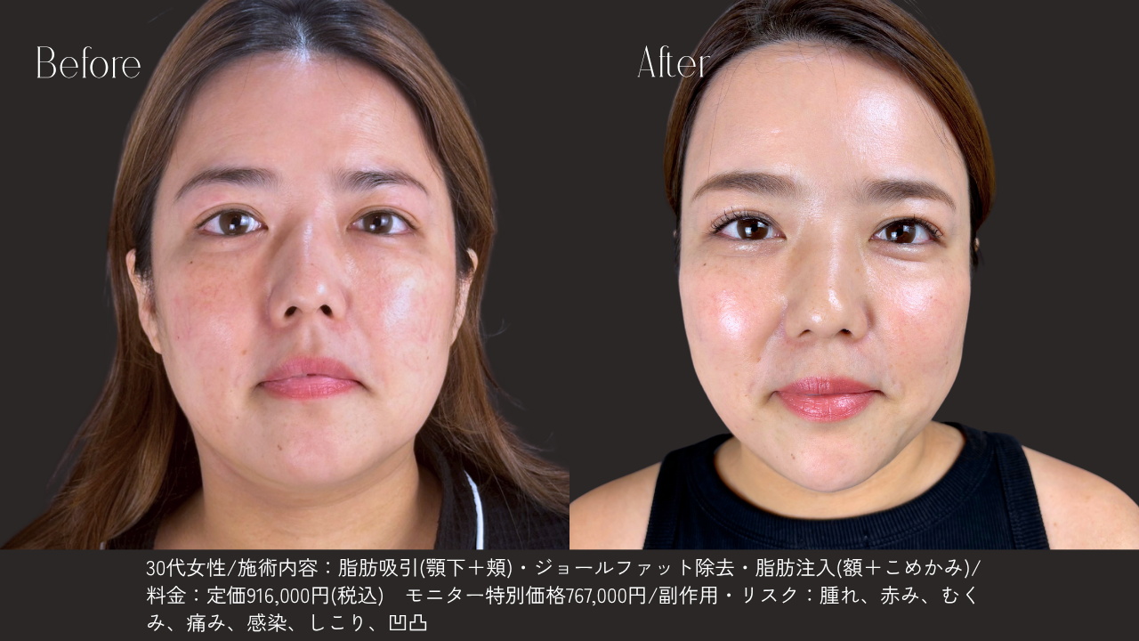 自然な仕上がりへのこだわり