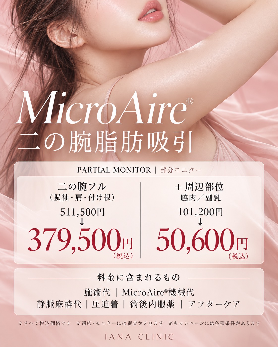 MicroAire® 二の腕脂肪吸引 ＜部分モニター＞