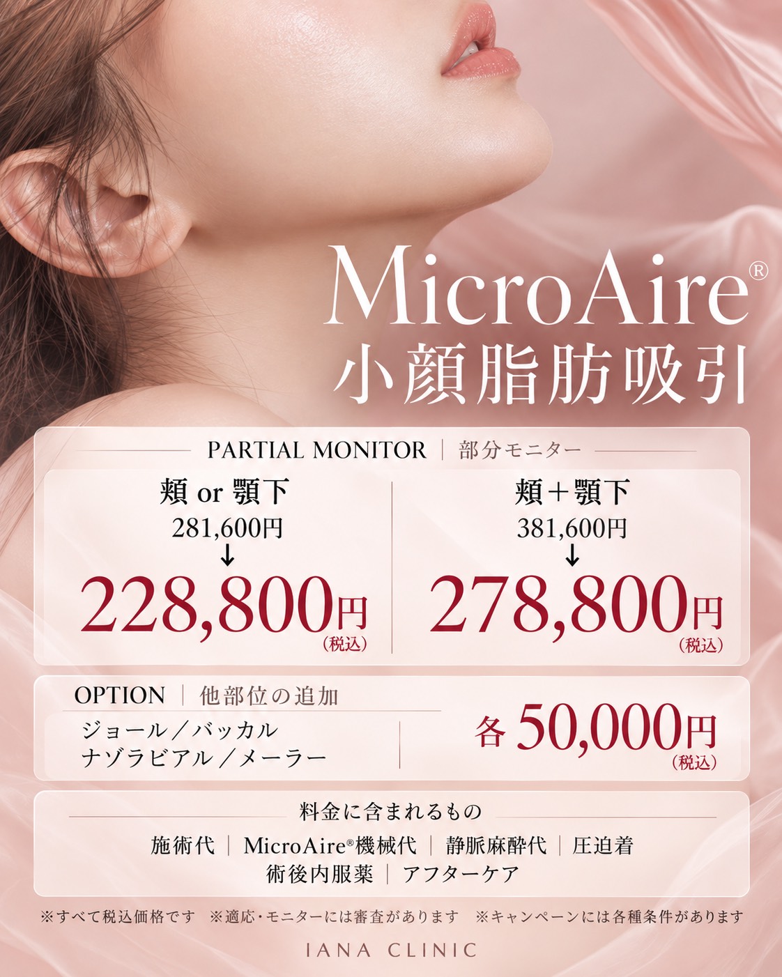 MicroAire® 小顔脂肪吸引 ＜部分モニター＞